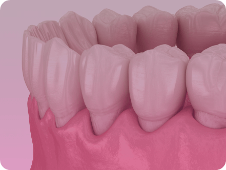 Periodontia